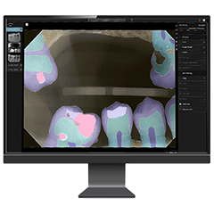 AI Radiographs